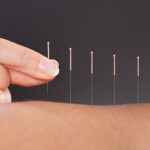 Acupuncture for chronic pain Alpert Acupuncture Chinese Medicine Clinic - מרפאת דיקור סיני