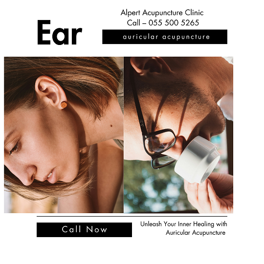 Auricular Acupuncture in Zichron Yaacov